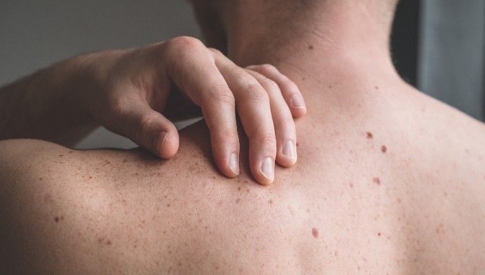 man scratches his back because it is itchy