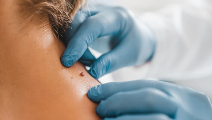 Woman having skin examined