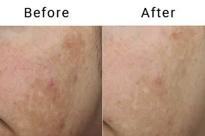 excel-V-before-and-after