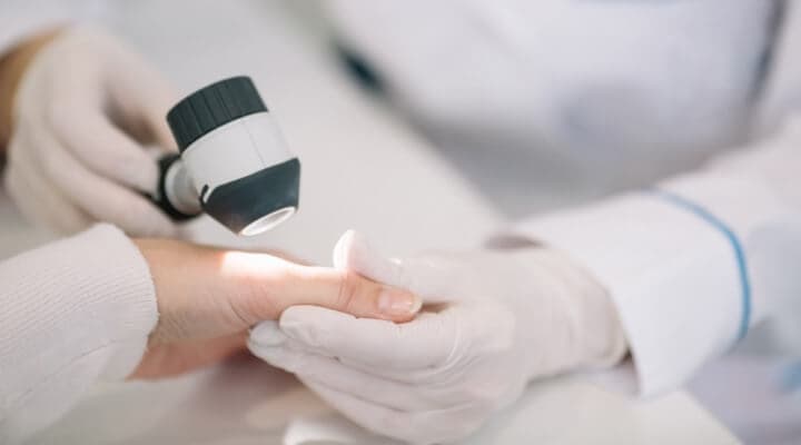 Diabetes and Your Skin