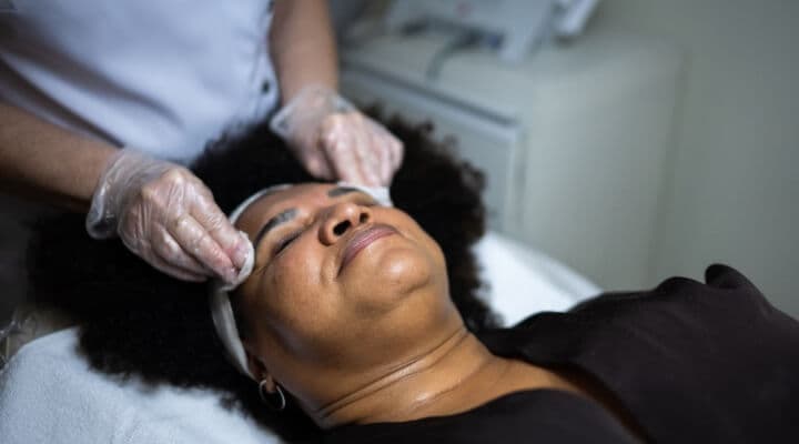 Chemical Peels: The Perfect Winter Treatment
