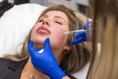 woman-getting-injectables