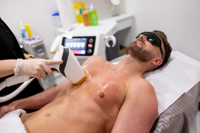 man-laser-hair-removal-on-chest