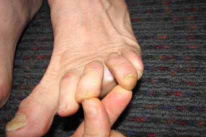 looking-between-toes