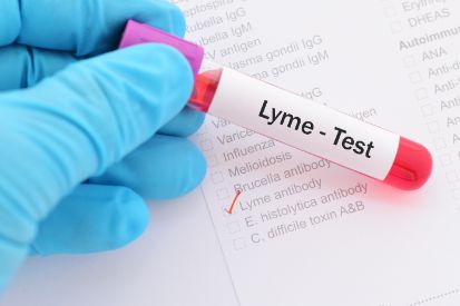 Lyme-Disease-test