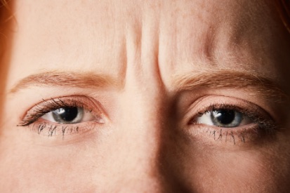Woman-forehead-wrinkles