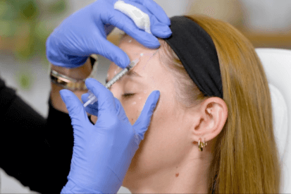 woman-getting-BOTOX-on-temples