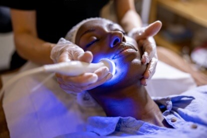 UVB-light-treatment-on-face