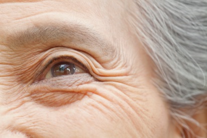 woman-wrinkly-eye